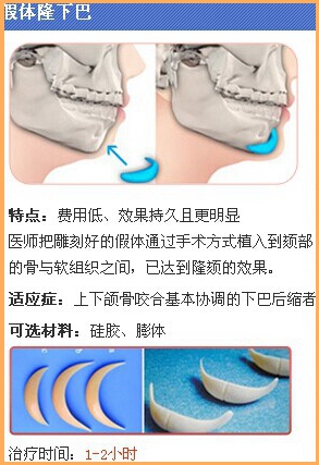 假体隆下巴