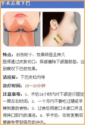 手术去双下巴