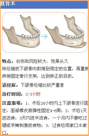 截骨术