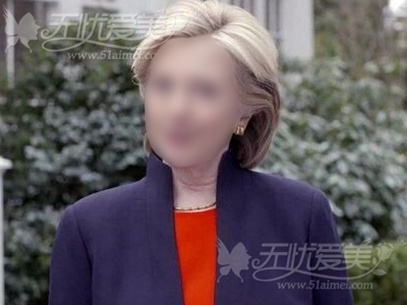 希拉里