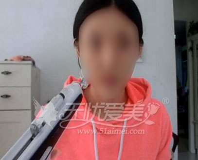自行注射美白针