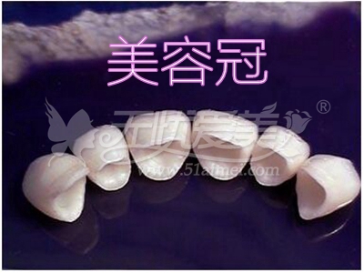 告别牙黄牙歪歪 为笑容加分