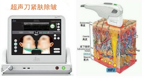 如果超声刀是去掉皱纹留下疤痕 你还敢用吗?