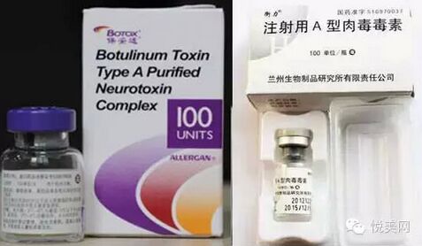 肉毒素注射