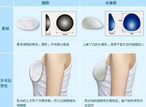 圆形,水滴形假体如何选择