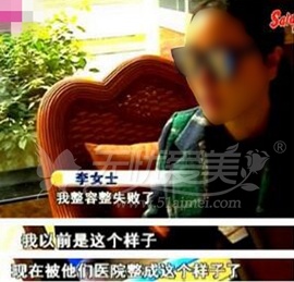假玻尿酸毁容