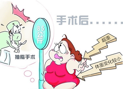 赴韩吸脂术前你必须知道的事