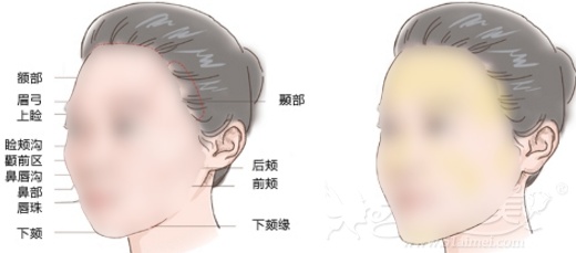 自体脂肪填充面部会导致皮肤下垂吗