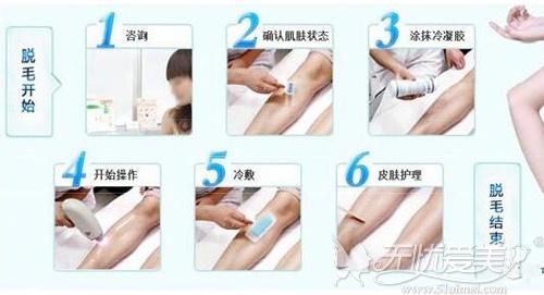 悬浮脱毛是什么原理_激光脱毛的原理是什么(3)