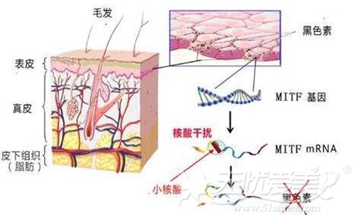 吸收的原理是什么意思_什么是牙槽骨吸收(2)