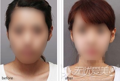 整形整容医院排名_上海整形整容医院