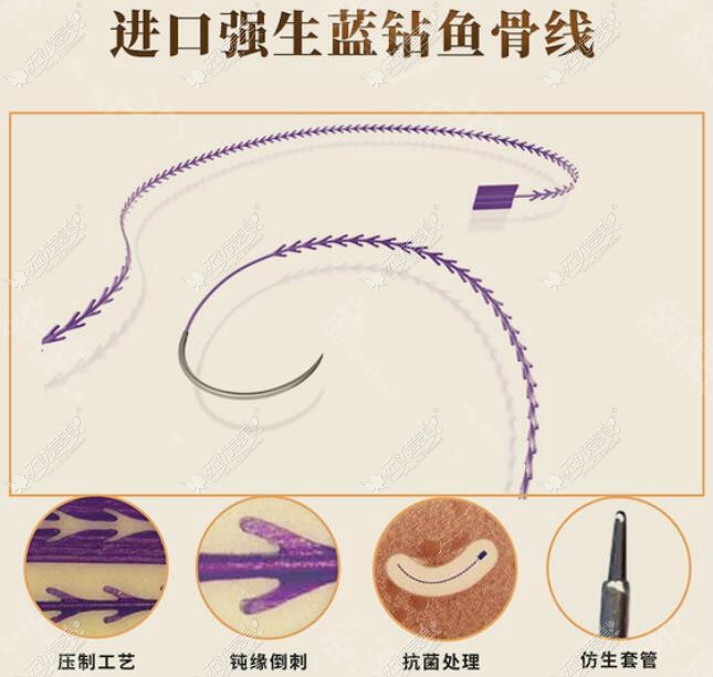 全面部做美国强生鱼骨线提升一共要用多少根线,有人做