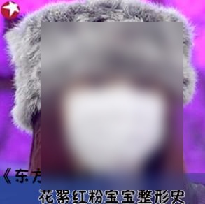 《东方直播室》花絮“红粉宝宝”整容经历