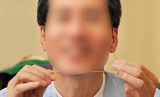 韩国美来医院金线除皱术 带动整形美容医学界革命