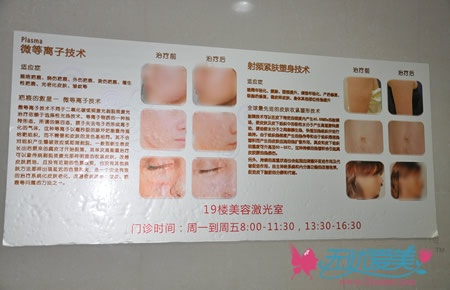 上海九院整形外科先进的激光美容技术