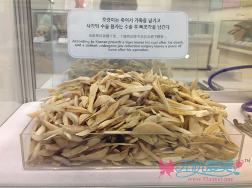 韩国BK整形医院博物馆陈列的下颌骨截骨材料
