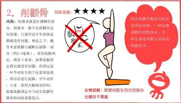 削颧骨