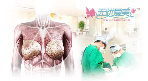 为什么韩国MD整形医院隆胸后不需要穿矫正衣