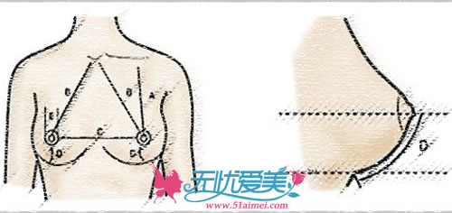 揭秘：韩国Face-Line整形医院扩大胸部手术