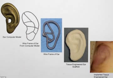 美科学家利用人类细胞培植出人造耳朵