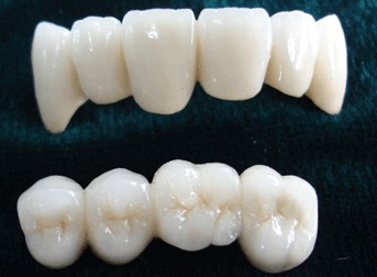 美容冠矫治适合哪八种畸形牙齿呢