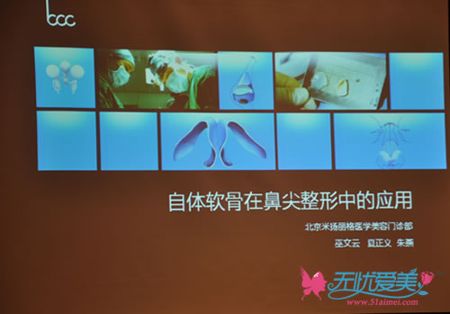 北京米扬丽格医学整形医院院长巫文云演讲《自体软骨在鼻尖整形中的应用》