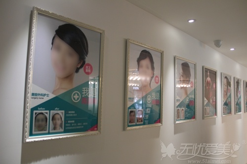 爱思特医院员工整形效果