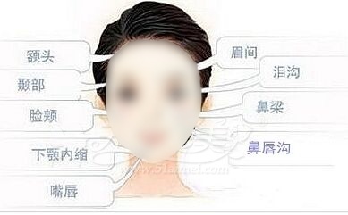 自体脂肪填充