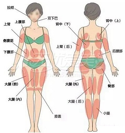 全面解析溶脂针 有了它真的想瘦哪里瘦哪里吗