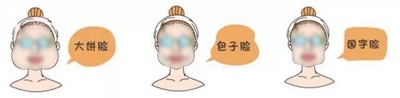 面部吸脂