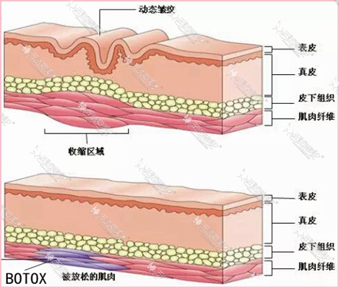 瘦脸除皱