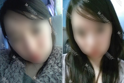 面部轮廓 终于让我告别了自己的大脸