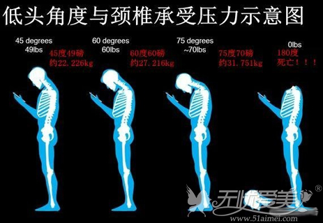 警惕“手机脖” 既谋杀颈椎还让脸上爬满皱纹