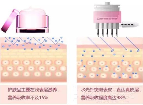 水光针能深入皮肤的底层