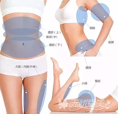 韩国冷冻溶脂仪使用身体的部位