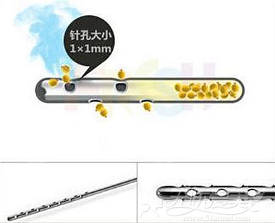 韩国PRP脂肪填充所用的纳米针头