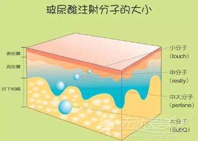 玻尿酸的大、中、小分子注射的部位不同