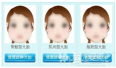 韩国X切骨V-line整形术 拯救你的四方脸