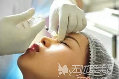 注射隆鼻适应症