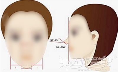 韩国自体肋骨隆鼻 同时满足鼻子高度、角度、弧度三大要素