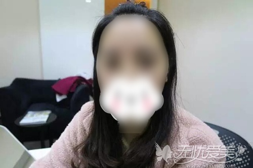 不戴眼镜的话眼球突出无神