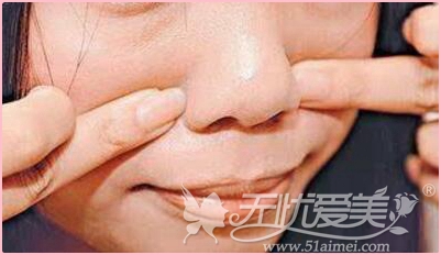 隆鼻后鼻假体变形