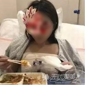 我在北京叶美人做假体隆胸手术后3天