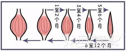 瘦肩效果维持