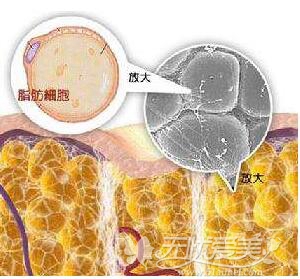 运动减肥的原理是缩小脂肪细胞体积
