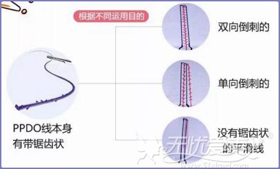 埋线提升使用的蛋白线