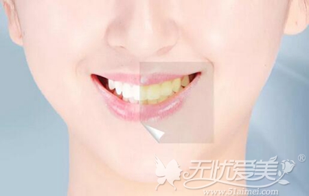 用美白牙膏和牙贴对付发黄牙齿靠谱吗?该怎么美白牙齿？