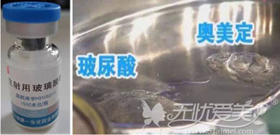 奥美定形态 奥美定形态