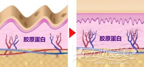 韩国LDM水滴提升效果