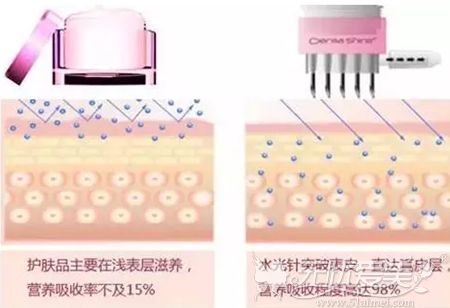 水光针注射补水